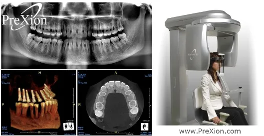 Photo collage: Panoramic x-rays of full upper and lower jaw, 3D imaging of upper and lower teeth, and image of a seated patient being scanned by 3D imaging machine